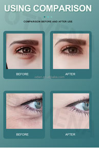 <span class=keywords><strong>Crema</strong></span> Contorno de <span class=keywords><strong>Ojos</strong></span> Instantánea OTVENA Anti-Puffy Best 60s <span class=keywords><strong>para</strong></span> Eliminar Arrugas - Product Image 5