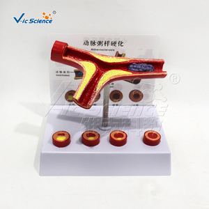 Modelo de vaso sanguíneo humano en forma de Y, que demuestra la bifurcación arteriovenosa, para fines educativos en la medicina. - Product Image 1