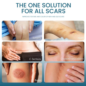 Vente en gros organique vergetures taches de rousseur pigmentation acné élimination des cicatrices crème gel pour les vieilles cicatrices - Product Image 4