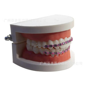 Appareils dentaires décoratifs colorés et tendance, attaches dentaires métalliques avec chaînes de thérapie orale disponibles dans toutes les couleurs - Product Image 4