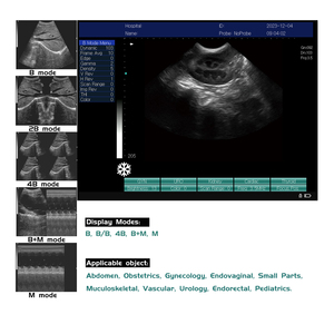 Camel sapi besar pemindai Ultrasound, alat pendeteksi kehamilan layar besar untuk ternak - Product Image 6