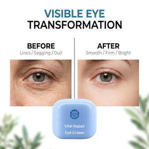 Crème Contour des Yeux Réparatrice Essentielle Complexe Peptidique Actifs Naturels Non Grasse Sans Parabène Sans Huile Sans Parfum Pour Tous Types de Peau Soin du Visage - Product Image 5