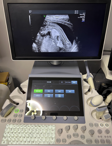 Fourniture et réparation d'écran tactile/écran LCD/moniteur pour machine à ultrasons Voluson E8/E10/E6 - Product Image 2