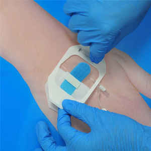 6cm x 7cm สติ๊กเกอร์รักษาแผลกาวตกแต่ง picc/cvc cannula indwelling เข็มแช่อุปกรณ์ - Product Image 1
