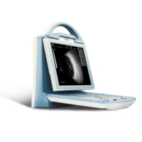 Équipement d'échographie Doppler AB ophtalmique pour hôpital, haute résolution, garantie 1 an, diagnostic intra-oculaire ROBIN ODU5