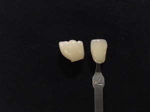 Bloque de Zirconia Dental, Consumible Dental, <span class=keywords><strong>Precio</strong></span> de Bloque de Zirconia 3D Plus, Bloque de Cerámica Dental para Cad Cam - Product Image 3