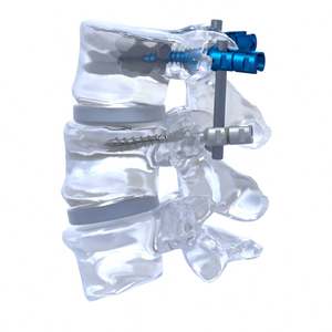 Placas de cuello preoperatorias Columna vertebral Implantes ortopédicos de titanio <span class=keywords><strong>Precio</strong></span> Implantes ortopédicos Fabricantes Implantes ortopédicos - Product Image 3