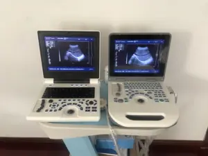 Medische Echographe Draagbare Beste Prijs Echographe Draagbare Real Fabricage Draagbare Ultrasound SUN-806H
