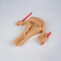Modelo de Silicona 3D de Útero para Sutura y Disección Laparoscópica e Histeroscópica en Ginecología y Obstetricia
