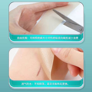 Pansements médicaux Sunflower pour cicatrices, 3 pièces par paquet, pour cicatrices de césarienne, brûlures, chirurgie, atténuation des vergetures hypertrophiques - Product Image 4