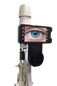 Equipo oftálmico Aparato de Oftalmología Imágenes Lámpara de hendidura <span class=keywords><strong>digital</strong></span> Sistema de imágenes AIO para diagnóstico de oftalmólogo - Product Image 2