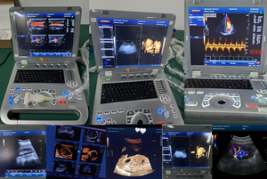 Échographe portable 3D et 4D de cardiologie le plus vendu, de bonne qualité, avec Doppler couleur 4D - Product Image 2
