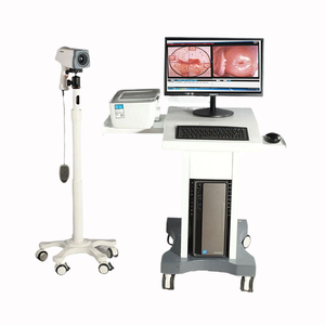 कर्नेल डिजिटल ट्रॉली वीडियो कोपोस्कोपी पोर्टेबल डिजिटल योनि वीडियो कोपोस्कोप के लिए सॉफ्टवेयर के साथ - Product Image 2