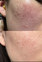 Offre Flash : Huile Réparatrice Visage Anti-Pigmentation, Nourrissante, Lissante et Éclaircissante pour la Peau