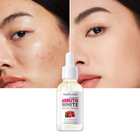Essence éclaircissante à l'arbutine OEM/ODM, correcteur de taches brunes avec alpha-arbutine et niacinamide pour l'hyperpigmentation, sérum pour le visage
