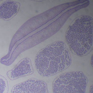 1 조각 남성 <span class=keywords><strong>Ascaris</strong></span> lumbricoides 기생충 준비 슬라이드 도매 공급 업체 - Product Image 4