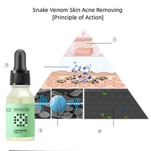 Serum perawatan kulit penghilang jerawat, perawatan kulit ular venom peptida Serum solusi Anti jerawat tanda jerawat - Product Image 5