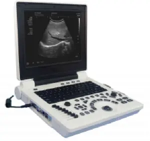 Black And White Laptop With Convex Array Probe China Portable Ultrasound Machine