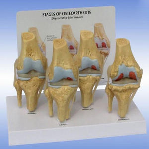 Modelo de Rodilla Humana con Simulación de PVC para Osteoartritis, Modelo Anatómico de <span class=keywords><strong>Esqueleto</strong></span> Médico - Product Image 2