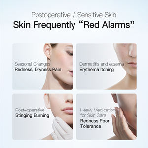 Juyou-Juego de cuidado de la piel personalizado, elimina el enrojecimiento, alivia la piel - Product Image 3