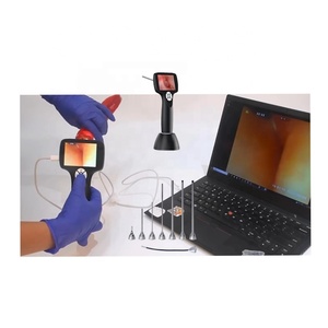 Câmera Endoscópica Digital para Ouvido de Animais de Estimação, Otoscópio para Cães e Gatos, Inspeção Médica HD - Product Image 3