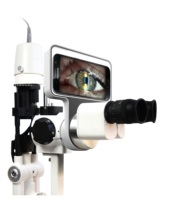 Sistema de Imagenología para Lámpara de Hendidura Inteligente de Alta Compatibilidad con Soporte OEM, Sin Necesidad de PC, Compatible con Dispositivos Móviles para Revisión Ocular