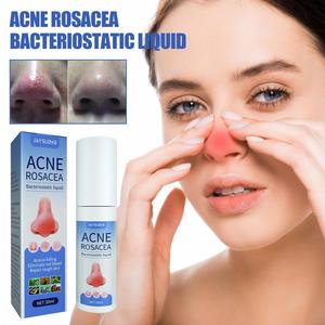 Jaysuing nhãn hiệu riêng mụn trứng cá rosacea điều trị Mũi Đỏ Thuốc mỡ huyết thanh acarus giết chết loại bỏ máu đỏ mũi sửa chữa da thô - Product Image 3