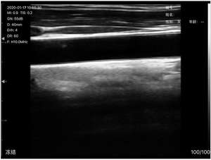 3 in 1 Mesin Pemindai Ultrasonografi Profesional Portabel untuk Jantung, Kebidanan & Kandungan, Mesin Ekokardiografi, Ecografo Portatil - Product Image 6
