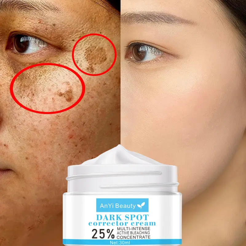 Correction Cream Deeply Cleans Skin Pores and Corners Moisturizes Moisturizes Removes Freckles and Whitens Cream