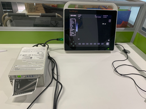 Instrumentos de Ultrasonido Médico de 15 Pulgadas, Precio Más Bajo, Ultrasonido Portátil con Pantalla Táctil Tipo Tablet - Product Image 4