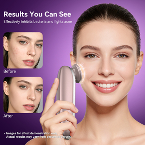 Producto <span class=keywords><strong>de</strong></span> Tendencia 2026, Instrumento <span class=keywords><strong>de</strong></span> Belleza Facial, Máquina para el Cuidado <span class=keywords><strong>de</strong></span> la Piel <span class=keywords><strong>de</strong></span> <span class=keywords><strong>Uso</strong></span> Doméstico - Product Image 2