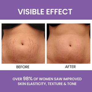 บาล์มบำรุงผิวลดรอยแตกลายออร์แกนิคสำหรับผู้หญิง แบรนด์ส่วนตัว ขายส่ง สำหรับดูแลผิวช่วงตั้งครรภ์ ลดรอยแผลเป็น - Product Image 5