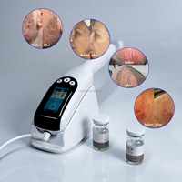 Nouvel outil de peeling à jet froid Ultra 3.0 20000V pour les soins du visage et du cuir chevelu