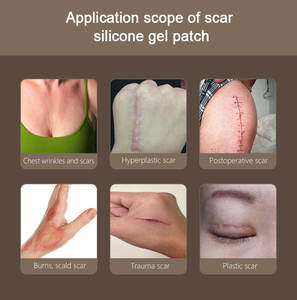 แผ่นเจลซิลิโคนสำหรับดูแลผิว ลดรอยแผลเป็น ยี่ห้อ Private Label - Product Image 3