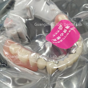 Prothèses fixes amovibles avec dents en métal en acrylique Externalisation de laboratoire dentaire Services complets - Product Image 5