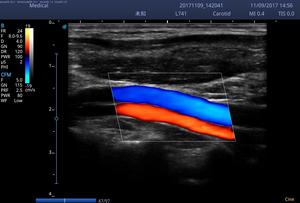 Sistema de Ultrasonido Doppler Color Portátil Veterinario SonoScape E2V para Clínicas Veterinarias e Imágenes de Diagnóstico en Campo - Product Image 5