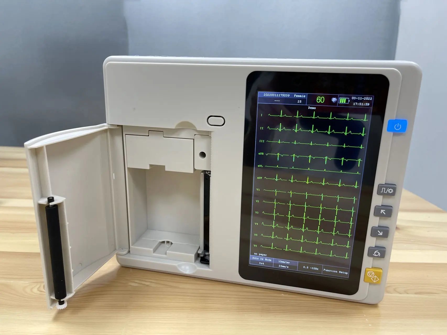 의학 ECG 기계 3 채널 휴대용 디지털 방식으로 ECG Holter ECG Electrocardiogram