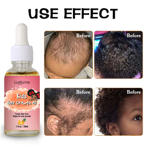 Sérum de croissance <span class=keywords><strong>des</strong></span> <span class=keywords><strong>cheveux</strong></span> africains Gouttes d'<span class=keywords><strong>huile</strong></span> pour enfants Bébé Marque privée Ananas naturel <span class=keywords><strong>Huile</strong></span> de croissance <span class=keywords><strong>des</strong></span> <span class=keywords><strong>cheveux</strong></span> pour enfants - Product Image 4