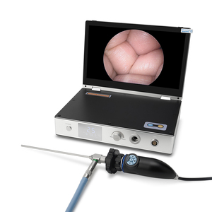 11.6inch Medical Endoscopy Camera System 4 in 1 1080P HD 30W <strong>LED</strong> <strong>Light</strong> <strong>Source</strong> 11.6&quot; Portable <strong>Endoscope</strong> Camera Medical All in One - Product Image 5