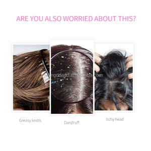 <span class=keywords><strong>แชมพู</strong></span>ซากุระสูตรอ่อนโยน ขจัดรังแค บำรุงผมชุ่มชื้น ควบคุมความมัน สำหรับทุกเพศ - Product Image 3