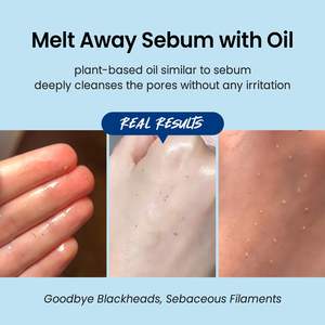 อัลตร้า ไฮยาลูโรนิค คลีนซิ่ง ออยล์ 150 มล. วีแกน ผลิตภัณฑ์ล้างเครื่องสำอางจากเกาหลี ช่วยเติมความชุ่มชื้น ไม่อุดตันรูขุมขน ไม่มีน้ำหอม - Product Image 4