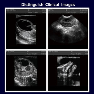 Camel sapi besar pemindai Ultrasound, alat pendeteksi kehamilan layar besar untuk ternak - Product Image 3