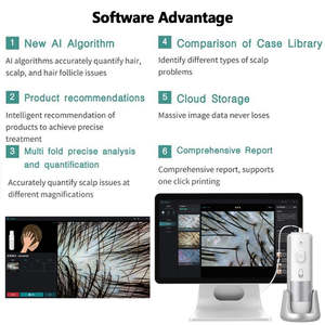 Analyseur de cheveux intelligent AI, analyseur de peau, analyse du cuir chevelu, soin du cuir chevelu avec stockage de données cloud, machine d'analyse des cheveux - Product Image 5