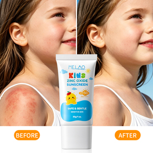 <span class=keywords><strong>Protector</strong></span> <span class=keywords><strong>Solar</strong></span> de Amplio Espectro para Bebés y Niños, SPF 50, Crema con Óxido de Zinc y Centella Asiática, Calmante para Piel Sensible Infantil, OEM ODM - Product Image 3