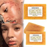 Savon OEM&ODM personnalisé, Savon de bain en gros, Savon anti-acné, Savon éclaircissant, Savon au curcuma, Savon blanchissant pour le visage