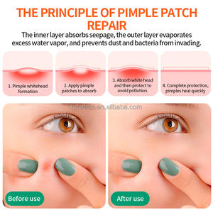 แผ่นแปะสิวเจลน้ำแบบกล่องกระจกแต่งหน้าลายหน้ายิ้มน่ารักและดาวหลากสีสัน - Product Image 4