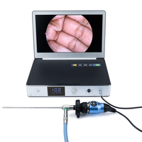 Endoscope nasal médical endoscope portatif laparoscopique caméra transforaminale colonne vertébrale interlaminaire