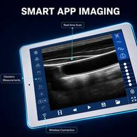 Escáner de Ultrasonido Inalámbrico Portátil, Compatible con IOS y Android, Sonda Doppler a Color de Bolsillo para Imágenes Abdominales y Obstétricas