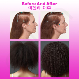 Luxfume 50ML Venta al por mayor Original planta nutritiva crecimiento del cabello para picazón y cuero cabelludo seco aceite para el cuidado del cabello - Product Image 4