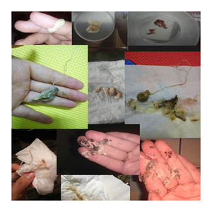 Thuốc đặt âm đạo thảo dược Bangdeli, sản phẩm vệ sinh phụ nữ, Tampon làm sạch vùng kín, viên ngọc thanh lọc Yoni, cuộc sống tươi đẹp - Product Image 5